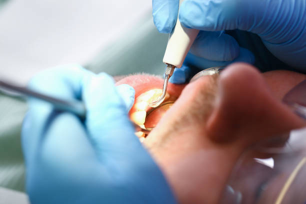 Emergency Gum Pain Relief in KS