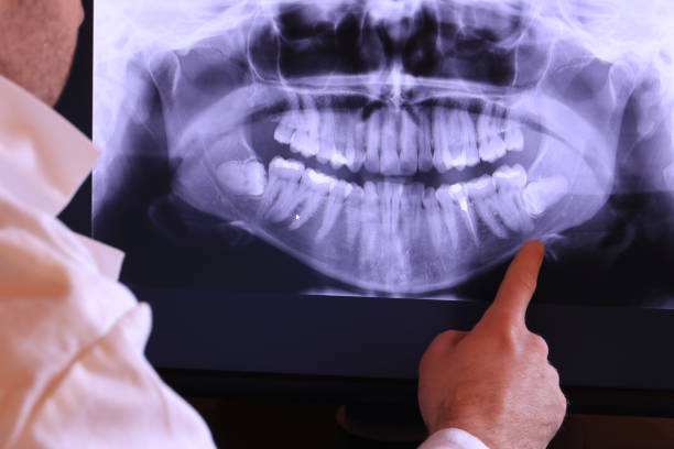 Best Cracked Tooth Emergency Dentist  in Conway Springs, KS